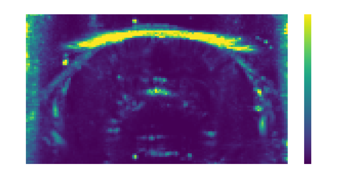 Coefficient of variation spatial map