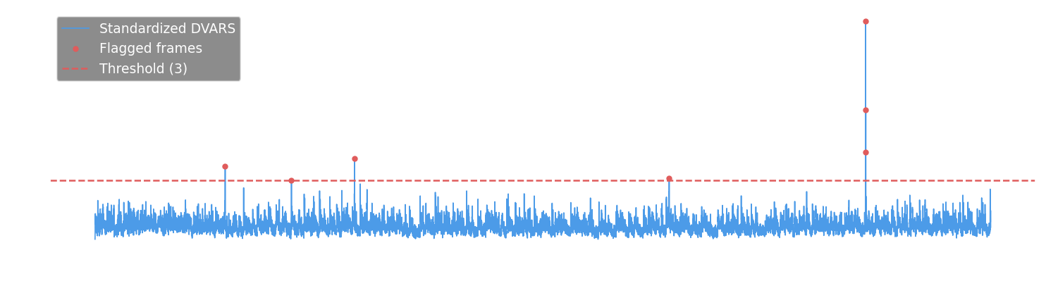 DVARS time series with threshold