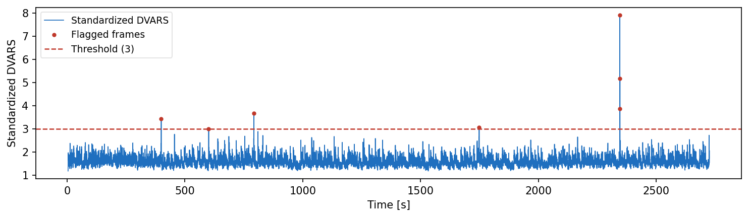 DVARS time series with threshold