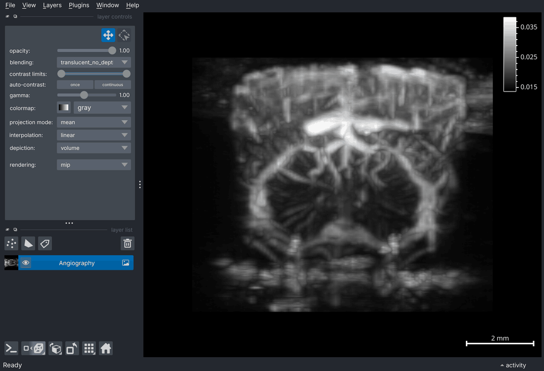 3D orbit of the angiography volume
