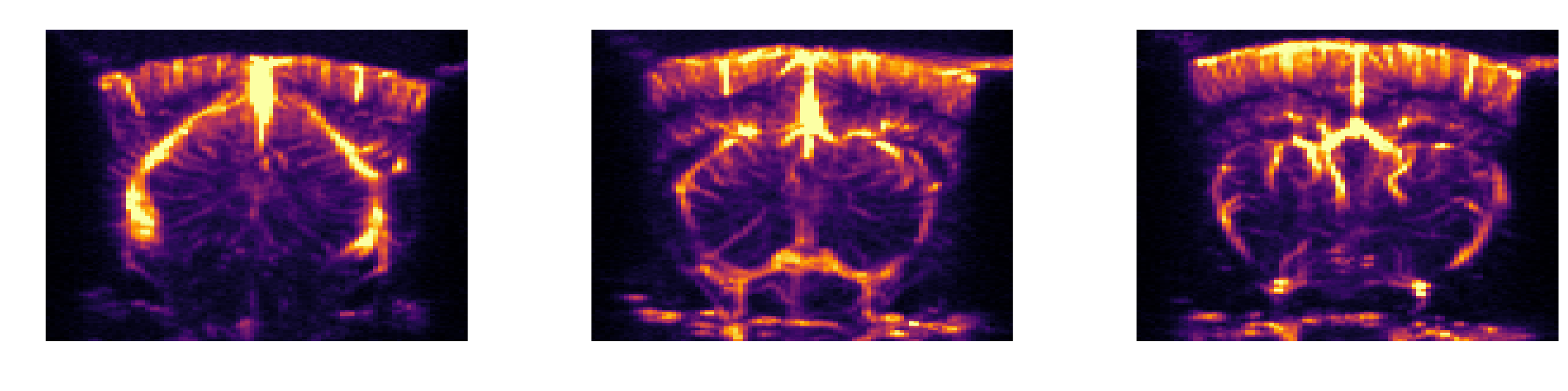Three selected elevation slices of the angiography volume