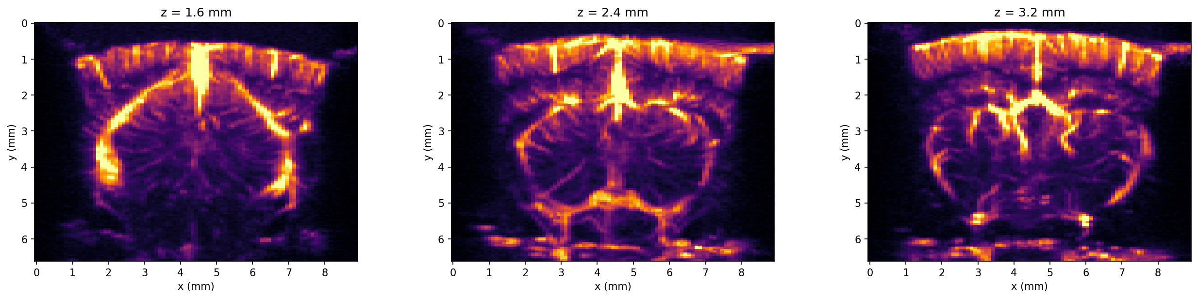 Three selected elevation slices of the angiography volume