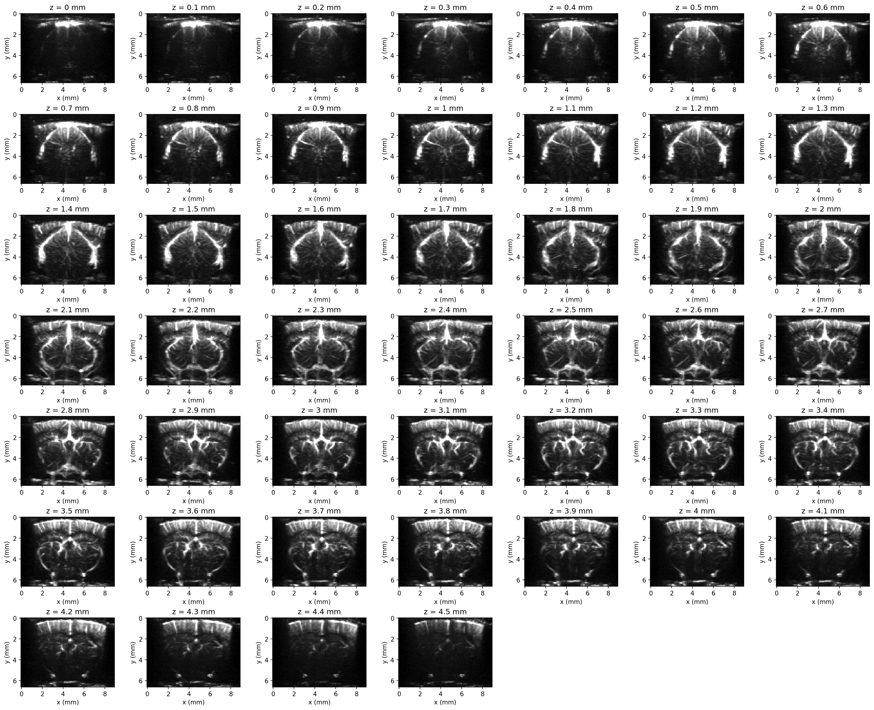 3D angiography volume shown as an elevation-slice grid
