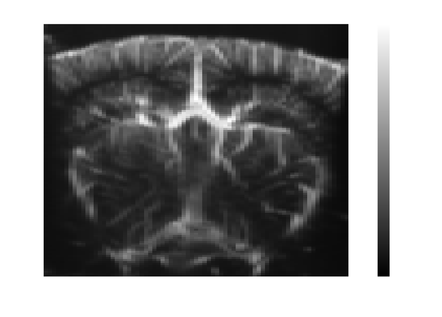 Mean power Doppler volume