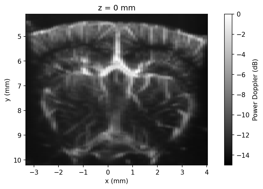 Mean power Doppler volume