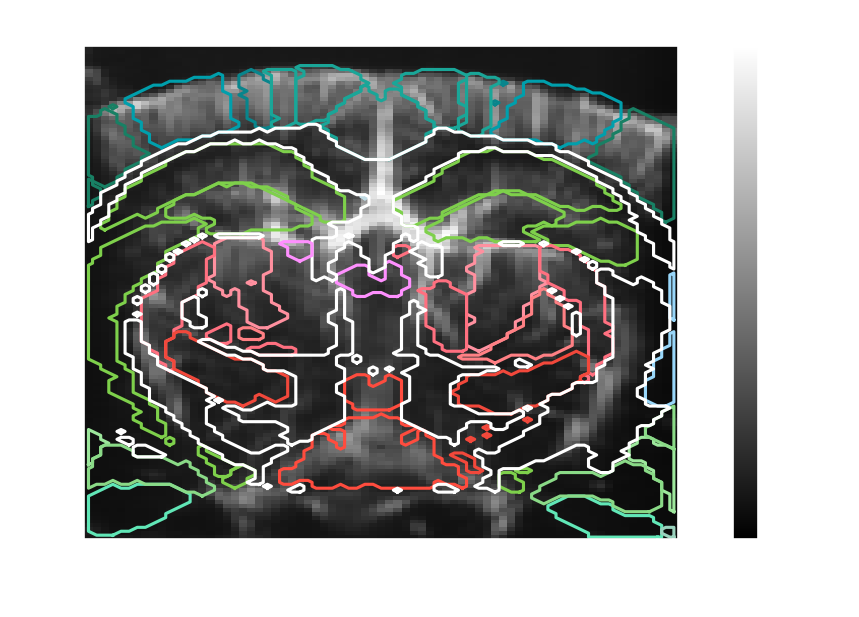 Power Doppler volume with Allen atlas region contours overlaid