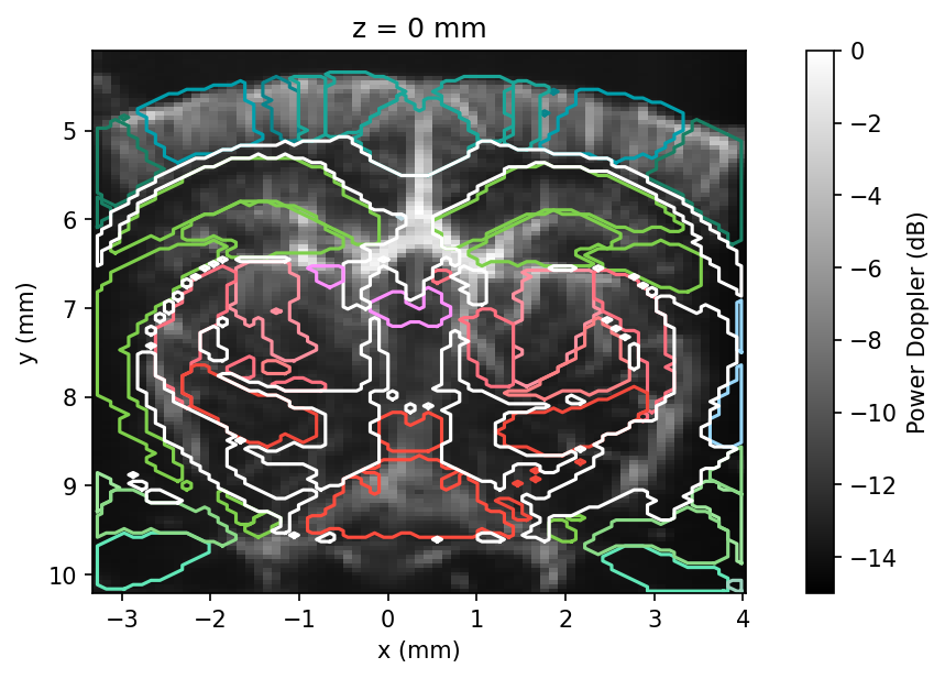 Power Doppler volume with Allen atlas region contours overlaid